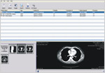 DICOM Viewer Worklist